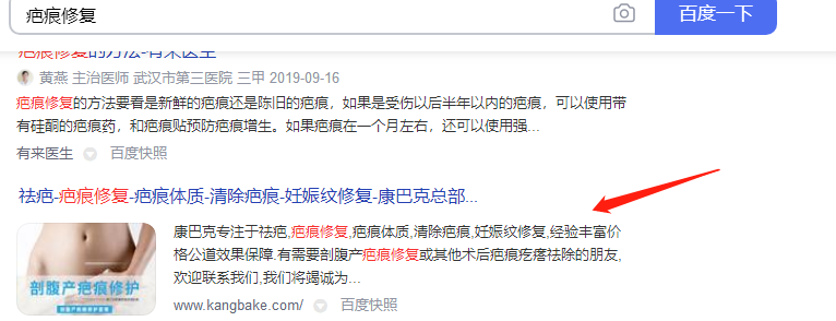 签约-青岛康巴可-百度关键词优化(图1)